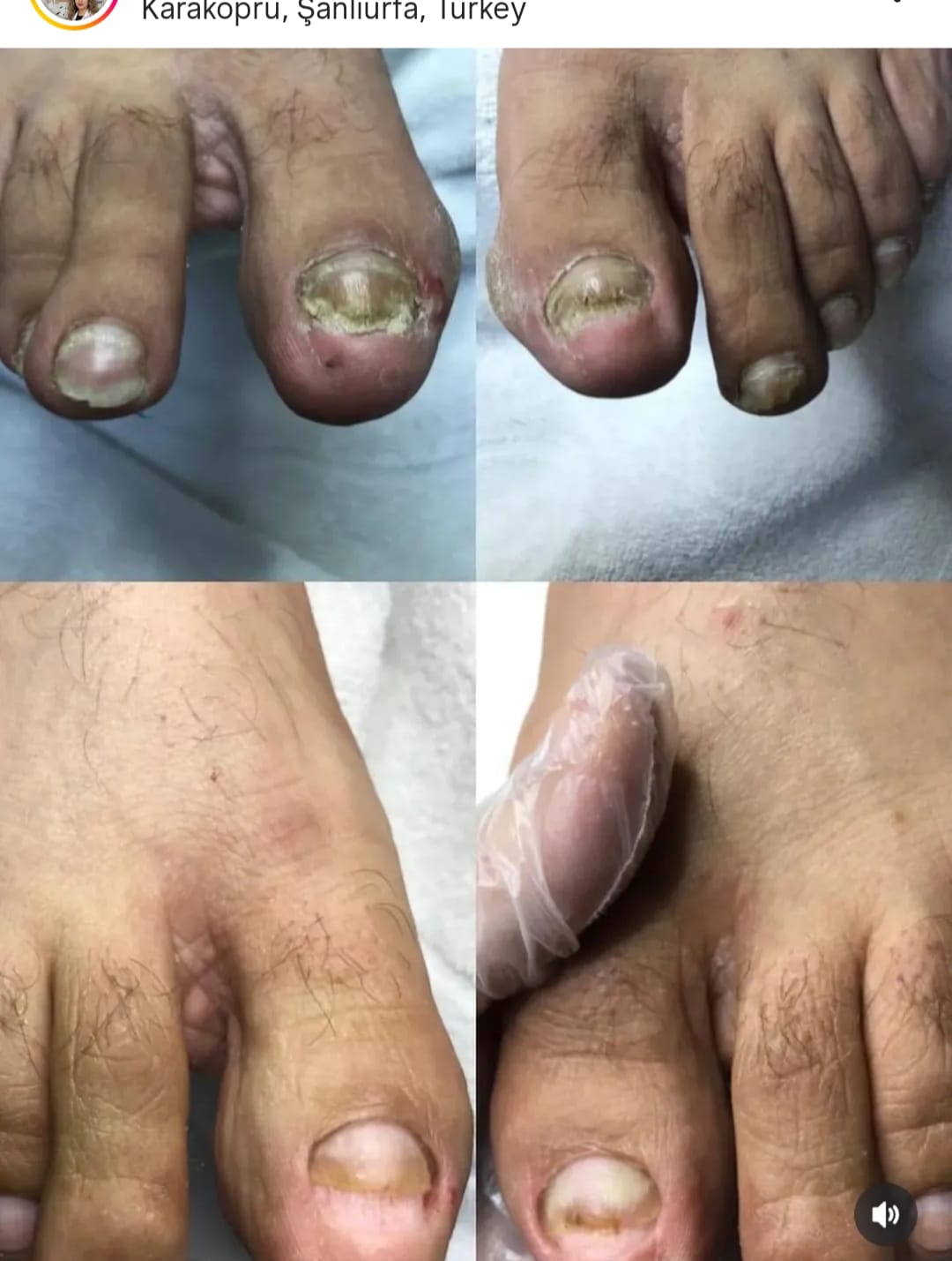 Zeynep Ergin Ayak Sağlığı Merkezi